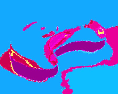 yy_p202
